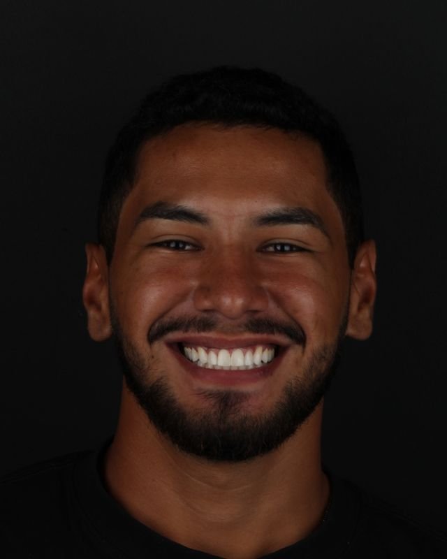 Paciente com o sorriso renovado